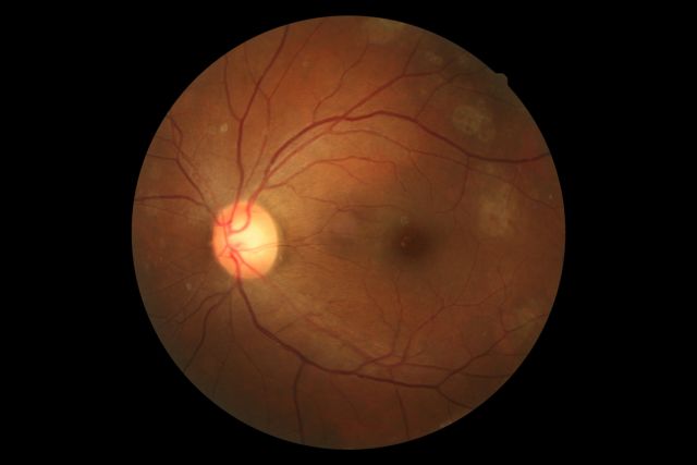 Πείραμα στην Ιαπωνία ανοίγει το δρόμο για καλλιεργημένα μάτια